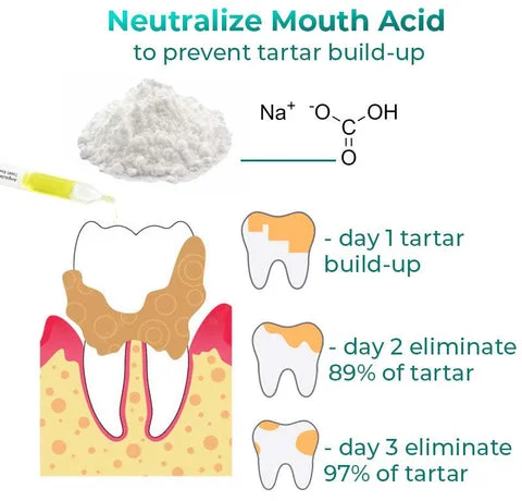 SmileMate™ Removal of tartar and plaque bacteria and various oral problems