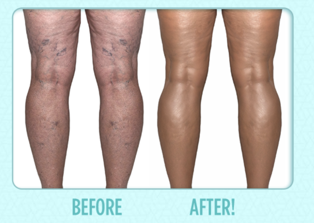 Instant Body Concealer, Instant Body Concealer