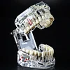 Dental Restoration Model Oral Pathology Doctor-Patient Communication Teaching Restoration Comprehensive With Nerve Part Removable Tooth Model