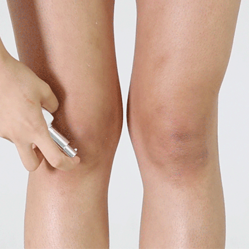 The start of skin transformation, APRILSKIN