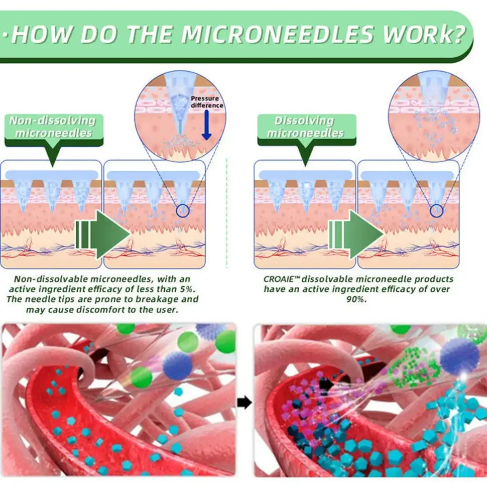 	Croaie&trade; SMGT-GLP-1 Nano Microneedle Patch