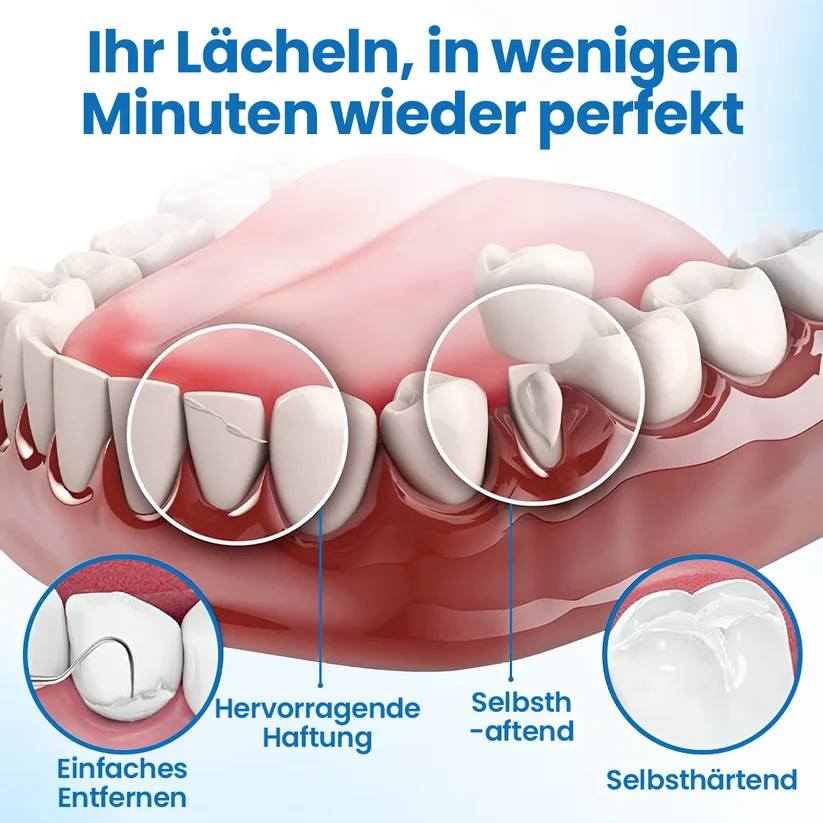 Zahnreparatur-F&uuml;llungsset