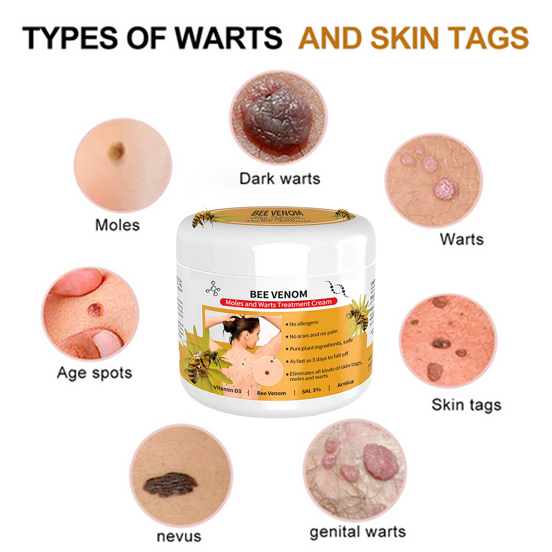 🐝🐝Bee Venom Mole and Wart Treatment Cream