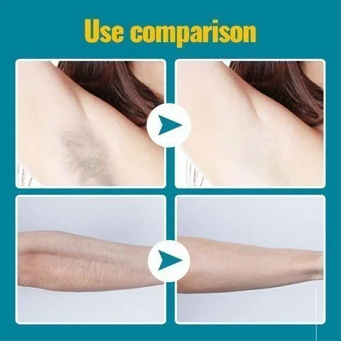 🔥BUY 1 GET 1 FREE &ndash; CRYSTAL HAIR ERASER