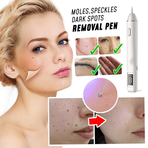 instant spots removal pen