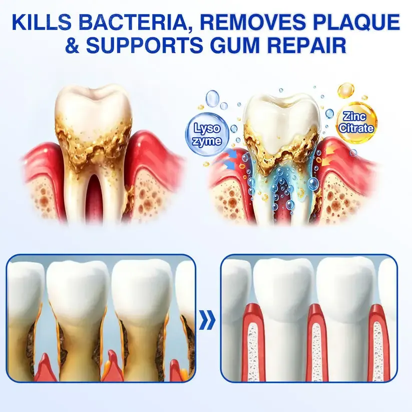 𝐆𝐮𝐦𝐑𝐞𝐯𝐢𝐯𝐞 Periodontal Repair Gel