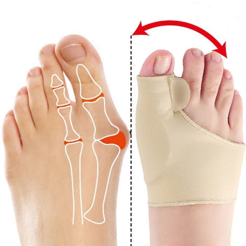 ToeGroove™ - The Big Toe Separator and Bunion Corrector