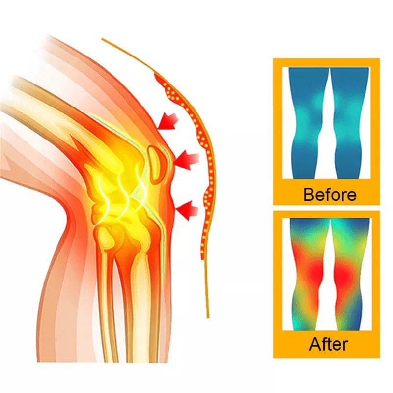 Tourmaline Acupressure Selfheating Knee Sleeve