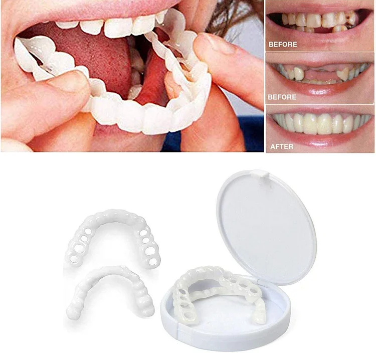 50% OFF  --Perfect Smile Snap-on Braces【BUY 2 GET FREE SHIPPING】