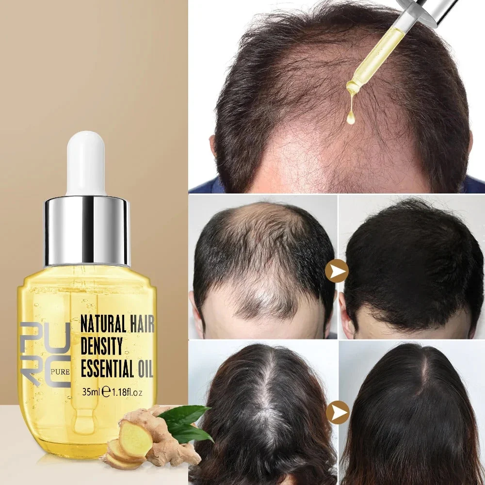 PURC™ Hair Growth Essential Oil - Reclaim Your Luscious Locks!