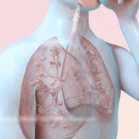 4Pcs Onnature Organic Herbal Lung Cleanse & Repair Nasal Spray Pro