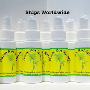 Haole Rot Natural Tinea Versicolor treatment, Topical Tinea Versicolor Cure ...