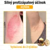 🧑&zwj;⚕️O&scaron;etrenie kožn&yacute;ch probl&eacute;mov zahňa: vekov&eacute; &scaron;kvrny, jazvy, bradavice, kožn&eacute; akn&eacute;, furuncle, akn&eacute;, ekz&eacute;my, psori&aacute;za, acne inversa, akn&eacute;, jazvy po akn&eacute; a in&eacute;.