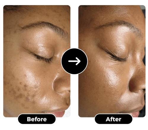 j9o8.png__PID:5936a603-e72c-4a0b-b727-3221a307c2bc