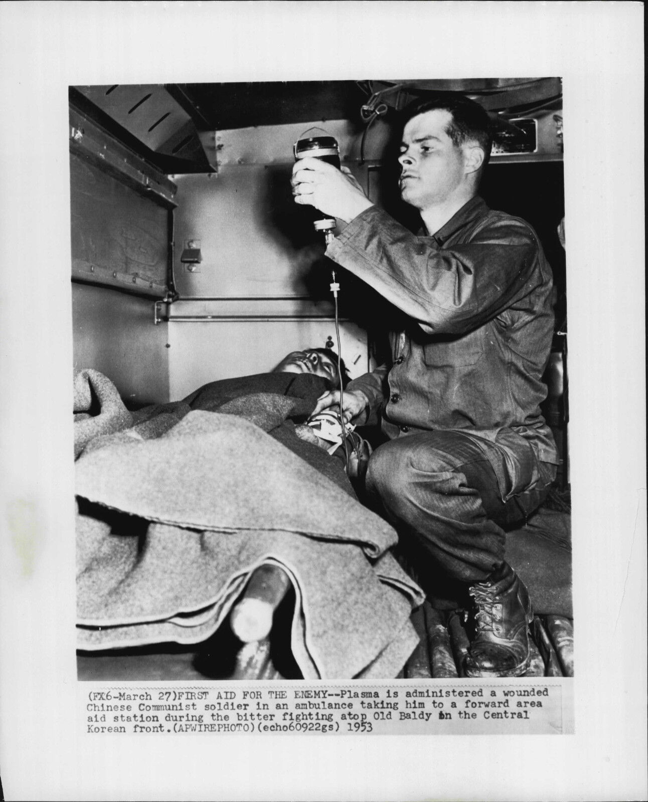 Wounded Communist Soldier Gets Plasma At Old Baldy 1953 Korea War Press Photo Poster painting