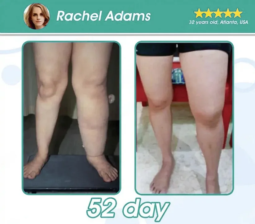 Nanpusa&reg; GLP-1 Slimming Essence Pearls