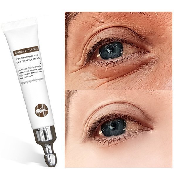🔥LAST DAY 49% OFF - ANTI-WRINKLE MAGIC EYE CREAM