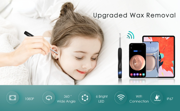 ear wax removal