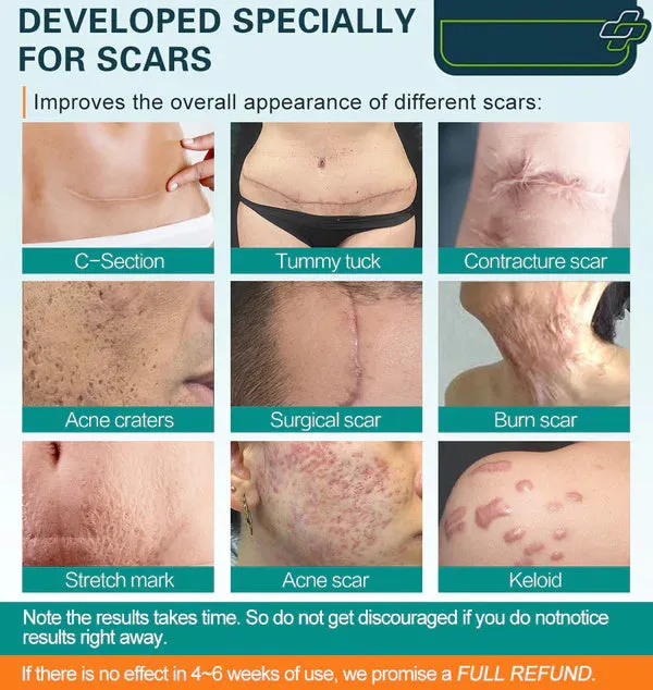 ️Advanced Scar Spray For All Types of Scars - For example Acne Scars ...