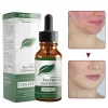 10ml Tea Tree Oil Moisturizer Face Body Skin Care Oil Control Fragrance Aromatherapy Pure Massage Essential Oil