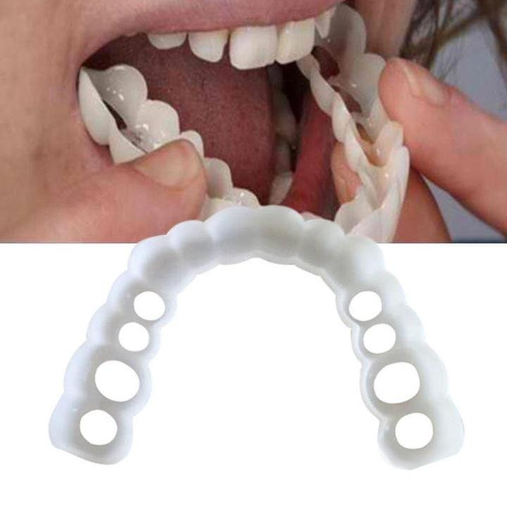 List 98+ Pictures pictures of snap-on dentures Completed