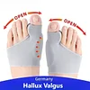 🔥Hallux Valgus Correctors - You will not feel pain when you walk anymore
