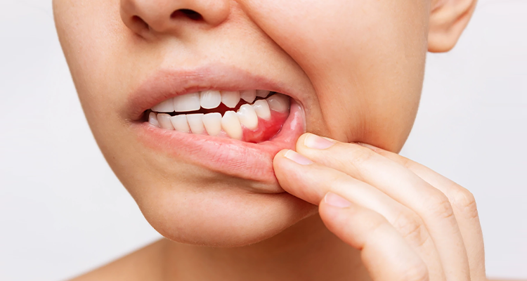 Why Do My Bottom Teeth Hurt? - Full Analysis
