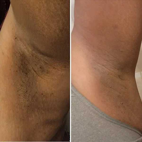 Turmeric Wash and Care two PieceSet 42