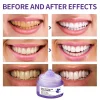 🦷Teeth Restoration Mineral Powder