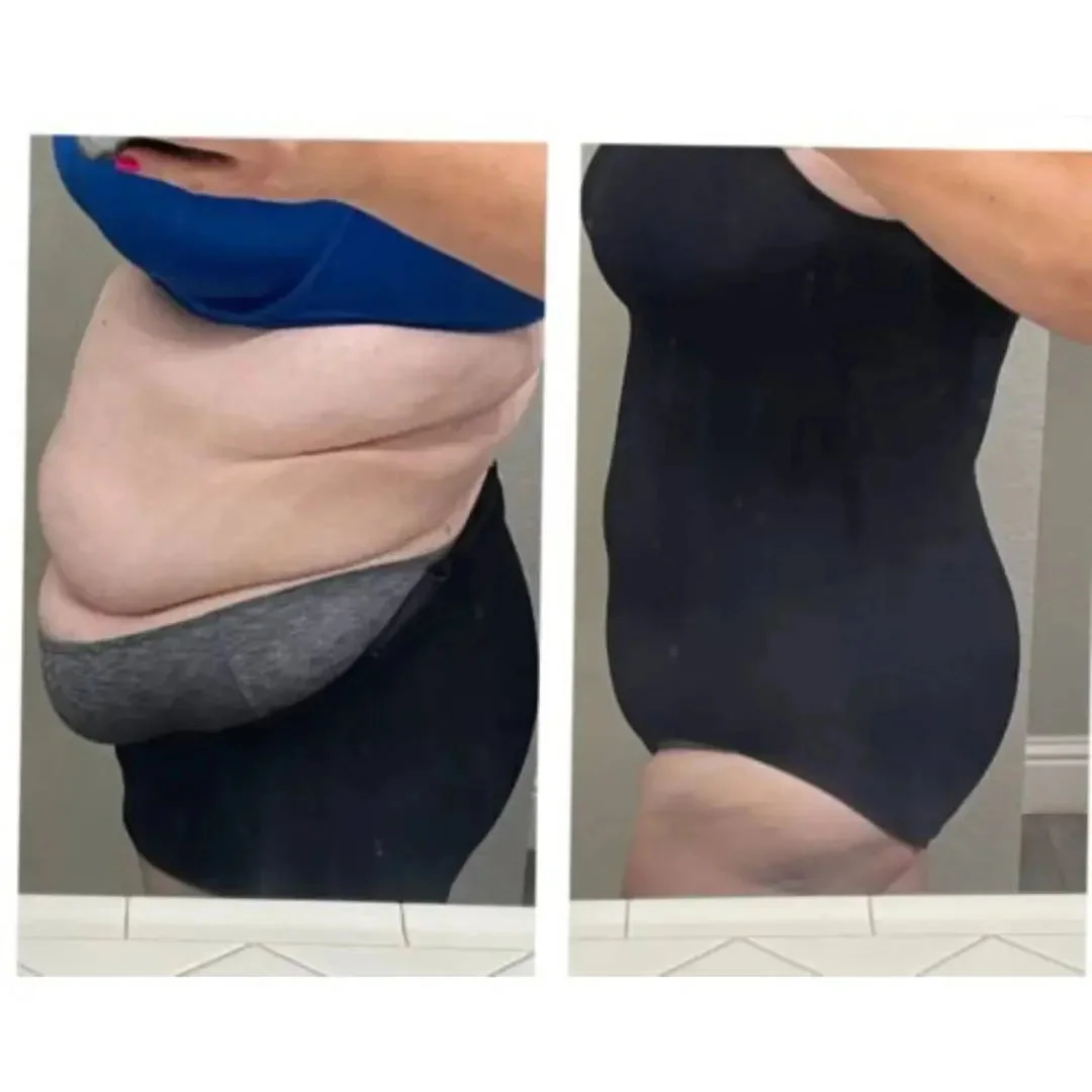 Open Gusset Body Shaper Bodysuit