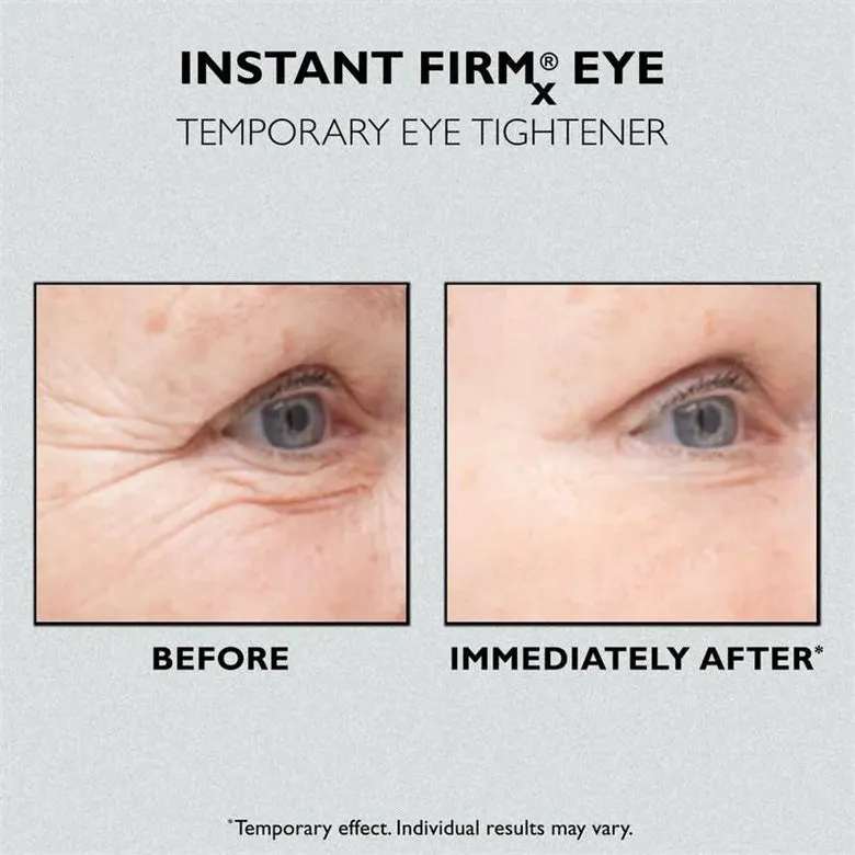 Last Day 49% OFF🎁Instant Eye Temporary Eye Tightener💕