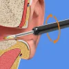 Cuill&egrave;re d'&eacute;limination de cire visible Wi-Fi, otoscope de charge USB HD