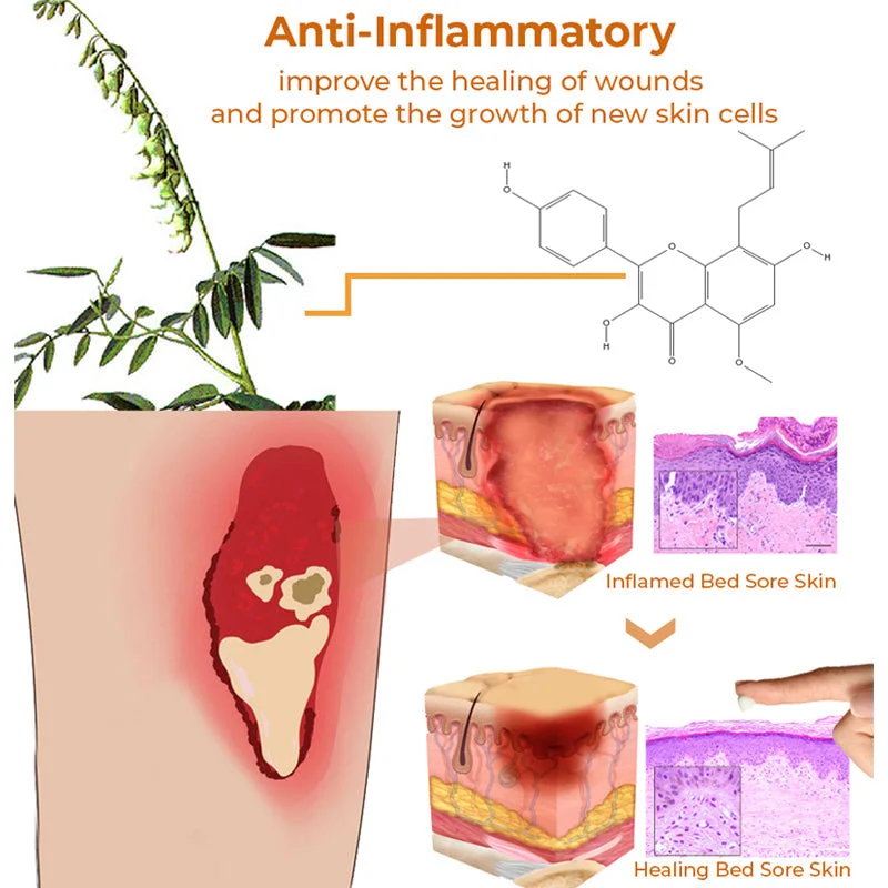 Bed Sore Treatment Cream