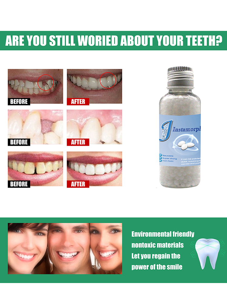 

10g/30g Gap Falseteeth Solid Glue Denture Temporary Adhesive Tooth Repair, 501 Original
