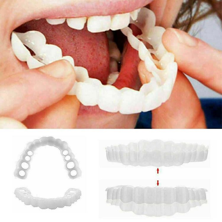 Smile Braces Snap On Upper Fake Teeth Dental Veneers Denture Cover Set