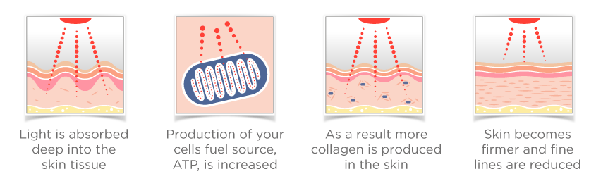 Collagenius EMS Facial Toner With LED Light Therapy | StressNoMore