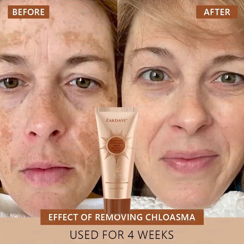 	Zakdavi&trade; Radiant Whitening & Spot Eraser Mask