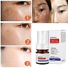 🔥Vitamin C Whitening Freckles Face Cream Remove Melasma Dark Spots Lighten Melanin