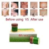 Khalesexx healthe 1pcs natural cream is very effective for psoriasis and...