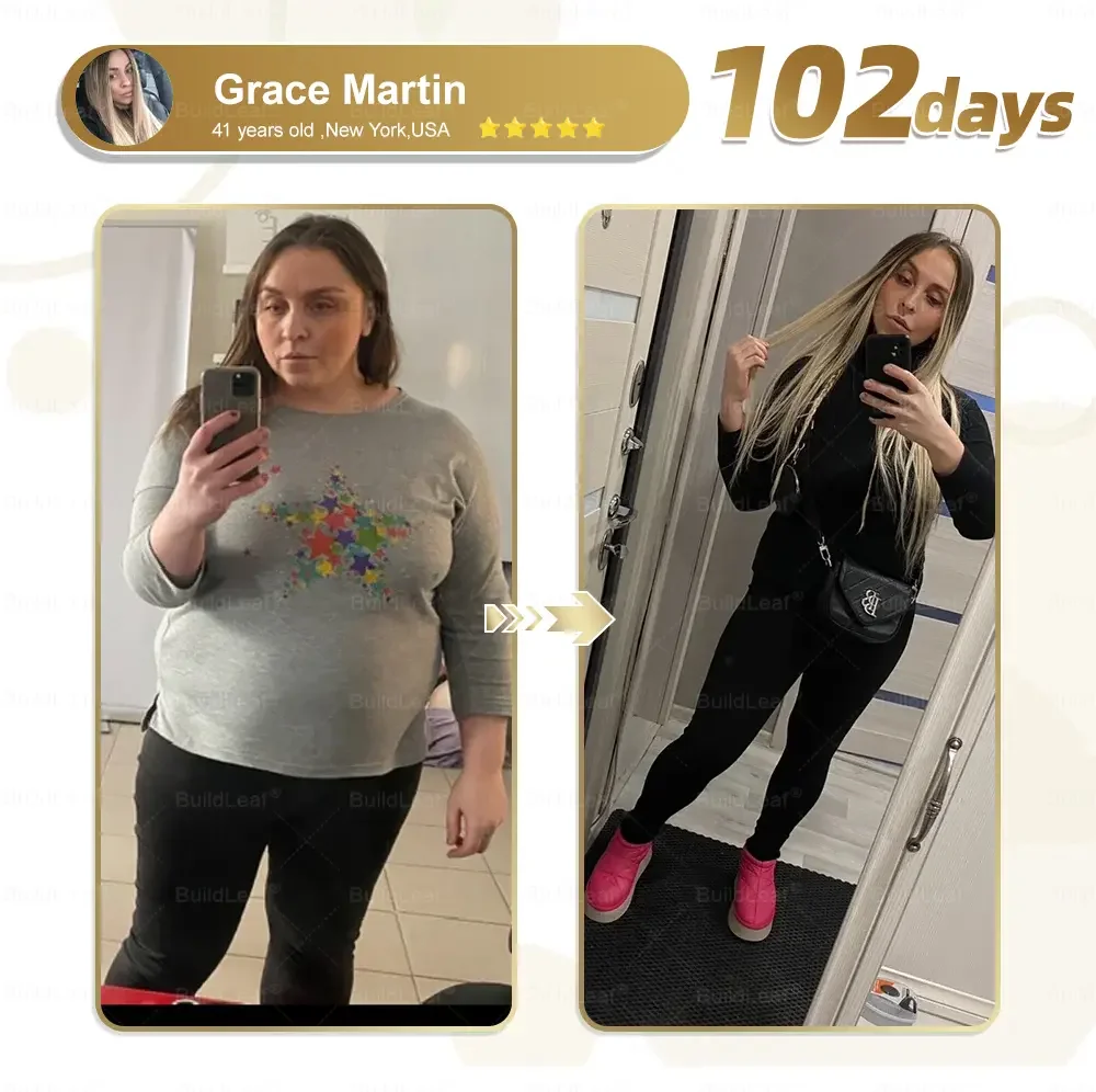 	BuildLeaf&reg; NIDDK-Tirzepatide Slimming & health NANO MICRONEEDLE PATCH