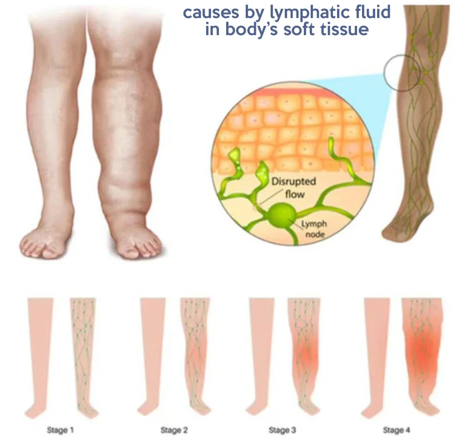 🔥LAST DAY 50%OFF🔥Smart Back Support