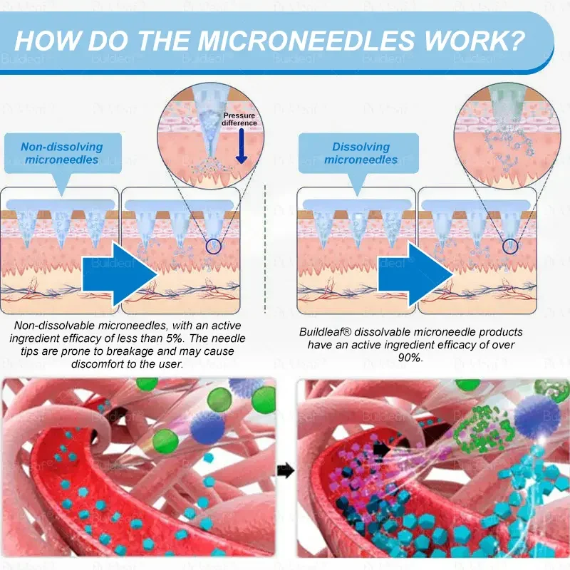 	Buildleaf&reg; Tirzepatide Nano Microneedle Patch with Collagen & Matrixyl 3000