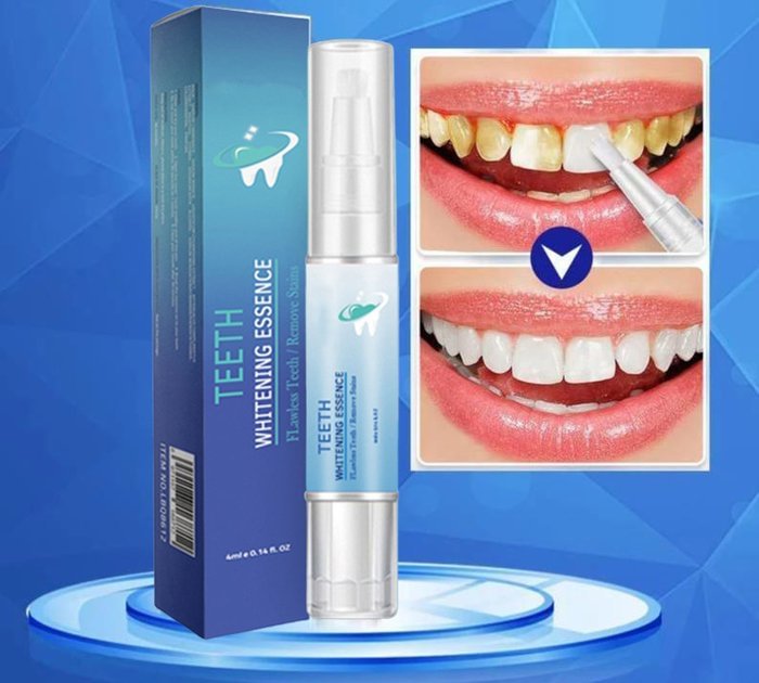 Mint Sincerely Teeth Whitening Pens