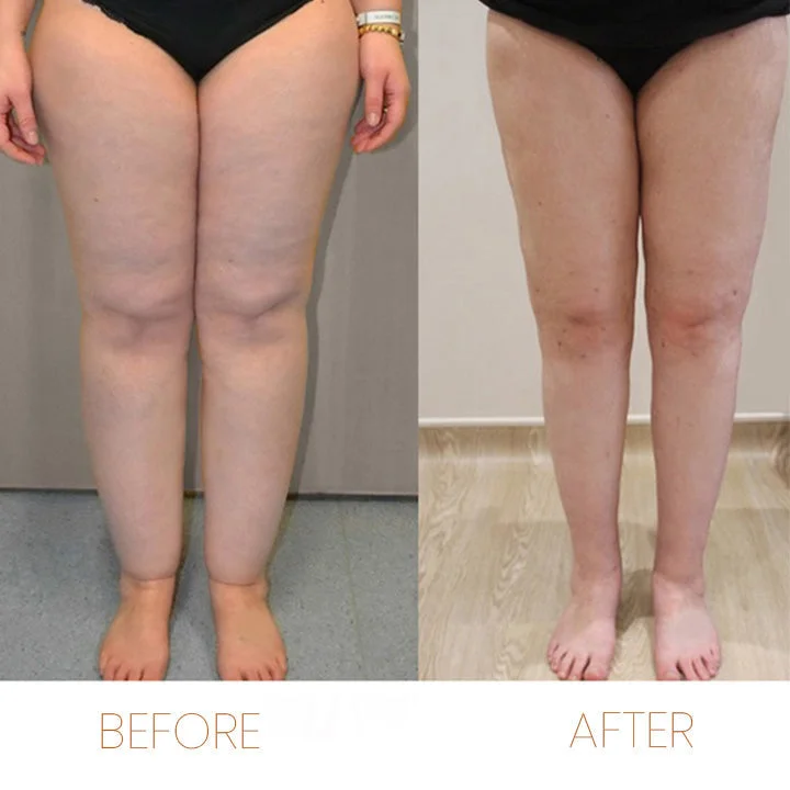 Last Day 49%🔥Herbal oils for detoxifying and cleansing the lymphatic system!!