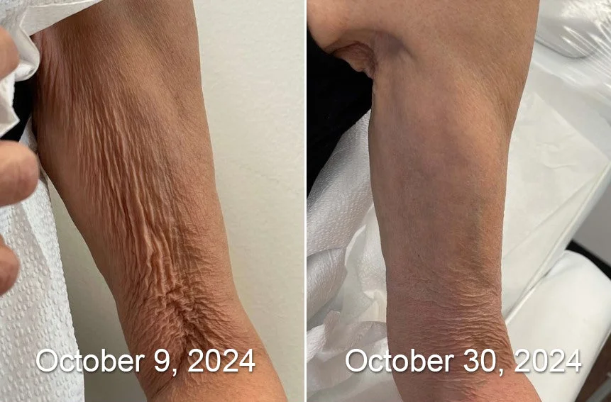 Laozik™ Botox Bee poison Firming Serum Stick