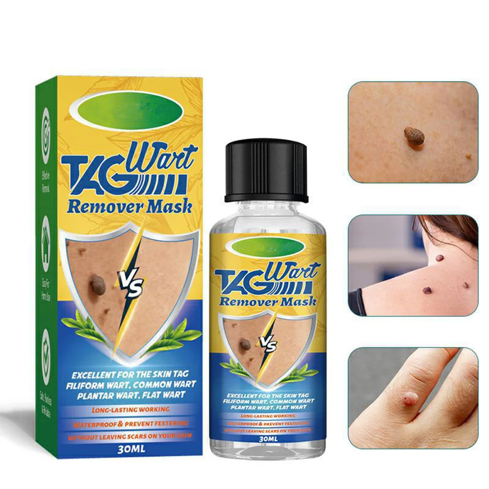 TAGAway Moles & Warts Removal Solution