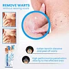 Maximum Performance Ointment for the Immediate removal of Warts