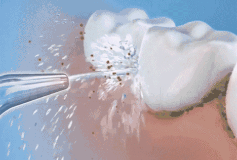 Wosser Cordless Dental Cleaner | Portable Water Flosser - GadgetAMP