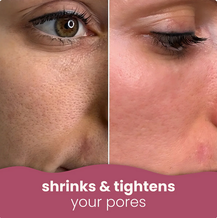 Natural Brightening Turmeric & Kojic Acid Pads | 50 Pack