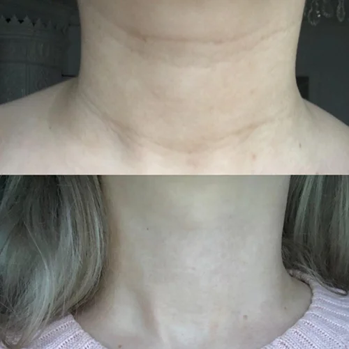 50% OFF Sale! EELHOE Collagen Anti-Wrinkle Cream